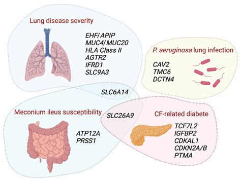 Cystic fibrosis - FrancesKomal