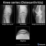 Awesome What Are The 3 Views Of A Knee X Ray Current Issues In Accounting