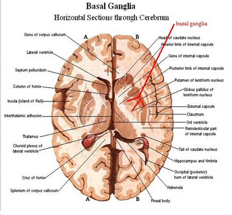 Pin em Hjerne | Cápsula interna, Sistema cerebral, Anatomia