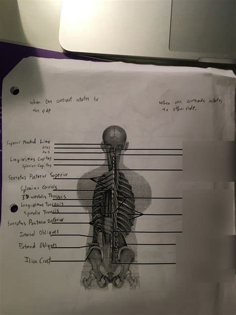 Ipsilateral movement Diagram | Quizlet