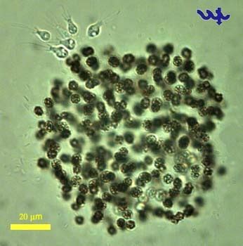 Microcystis