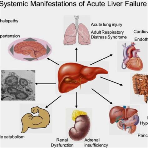 Pin on Live Donor Liver Transplant