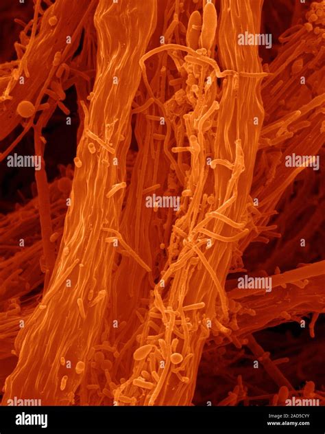 Coloured scanning electron micrograph (SEM) of Filamentous iron-oxidizing bacterium (Leptothrix ...