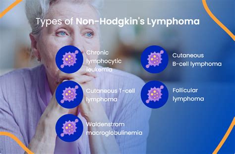 Non Hodgkin Lymphoma: Everything You Need To Know | ACTC