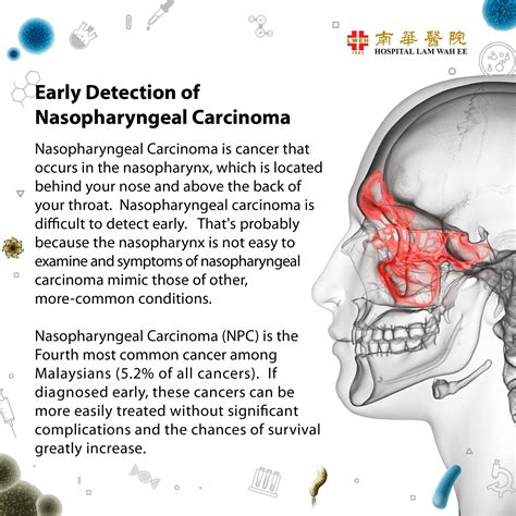 Nasopharyngeal Cancer