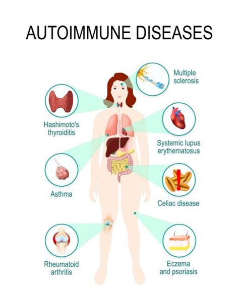 Immune System Diseases: Types, Symptoms, Prevention | STD.GOV Blog