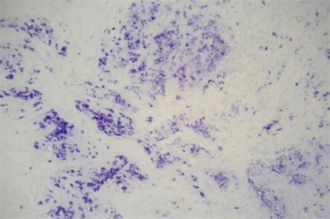 MAST CELL Animal Control Histology Slides - Newcomer Supply