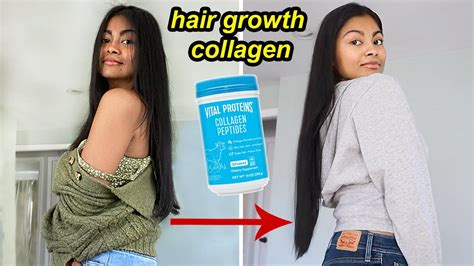 I tried HAIR GROWTH COLLAGEN for 4 months & THIS HAPPENED! | Before and after results - YouTube