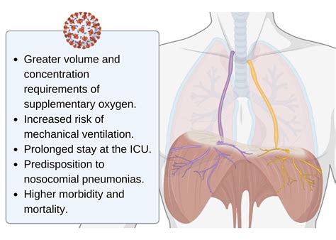 Acute Phrenic Neuropathy and Diaphragmatic Dysfunction as a Complication of COVID-19: A Report ...