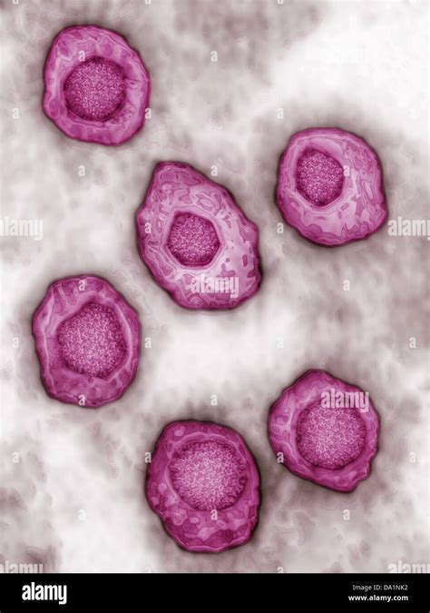 Epstein Barr Virus High Resolution Stock Photography and Images - Alamy