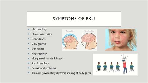 Phenylketonuria Symptoms