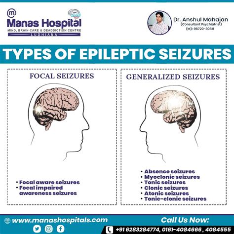 What all do you need to know about epileptic seizures and symptoms?