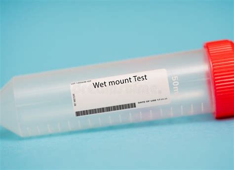 Wet mount Test stock photo. Image of laboratory, sample - 275972452