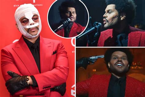 The Weeknd shows off freaky face from 'plastic surgery' in new music ...