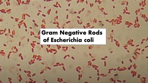 Gram Negative Rods of Escherichia coli - YouTube