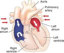 Diastole | definition of diastole by Medical dictionary