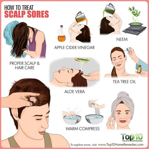 How to treat scalp sores #hairlosshomeremedies | Sores on scalp, Dry ...