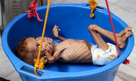 Yemen’s Nightmare: War Brings Famine | The Epoch Times