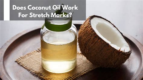 Does Coconut Oil Work For Stretch Marks?