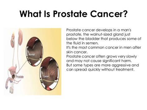 Prostate Gland Definition – applecool.info