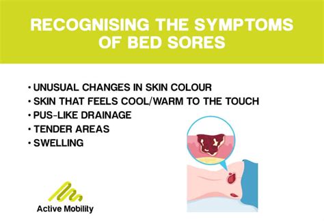 What Are Bed Sores & How Do You Prevent Them?