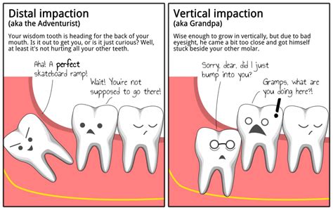 When Wisdom Teeth Grow – Boston Dentist – Congress Dental Group 160 ...