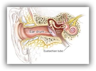 infant ear infection