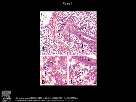 Protein restriction in pregnancy is associated with increased apoptosis of mesenchymal cells at ...