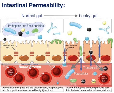 AIMA Functional Medicine - Intestinal Permeability