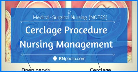 Shirodkar Cerclage Procedure - RNpedia