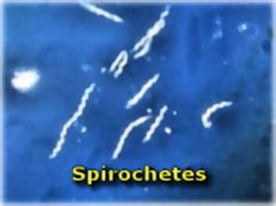 Spirochetes - what are they and what do they indicate in my microscopic exam - BIOLOGICAL WASTE ...