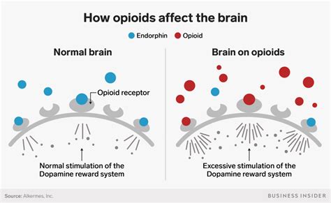 What are Opioids & Opioid Addiction? - PursueCare