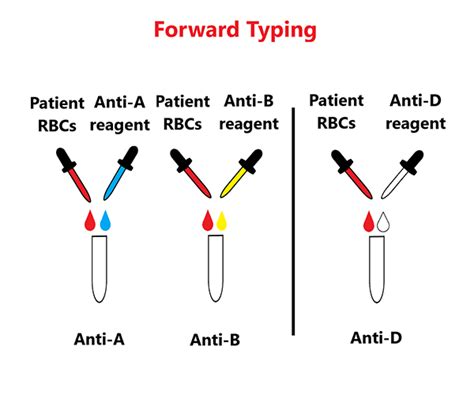 ABO Blood Group System Testing A Primer Blood Bank Guy, 59% OFF