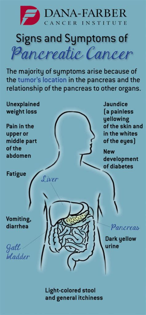 Diagnosing Pancreatic Cancer as Early as Possible - Living Well While Surviving Cancer