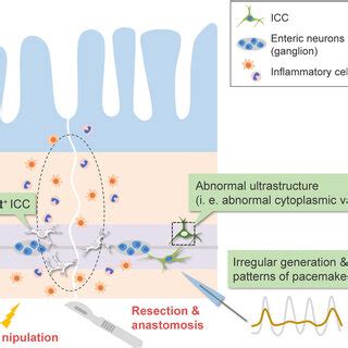 Interstitial cells of Cajal after surgical manipulation. Schematic ...