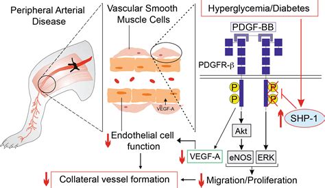 Diabetes Impaired Ischemia-Induced PDGF (Platelet-Derived Growth Factor) Signaling Actions and ...