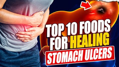 Top 10 Foods to Heal Your Stomach Ulcer Naturally - YouTube