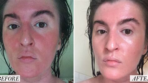 I Tried a Korean Skin-Care Routine for a Month - Before and After ...