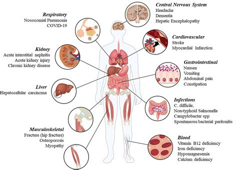 Cureus | Adverse Effects Associated with Proton Pump Inhibitor Use