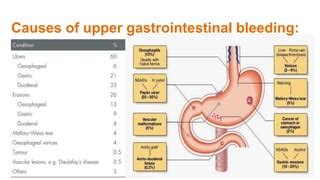 Hematemesis Causes