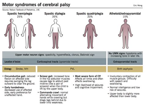 Cerebral palsy – McMaster Pathophysiology Review