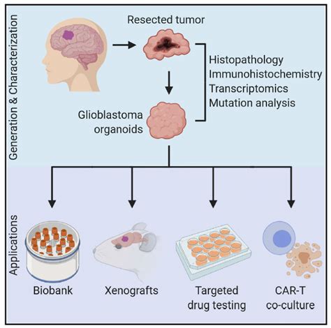 Improved Glioblastoma Treatments Could Lie in Tumor Organoids