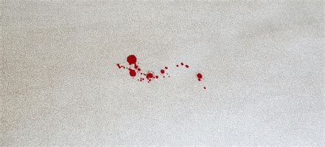 Cleaning Blood From Wool Carpet | Homeminimalisite.com