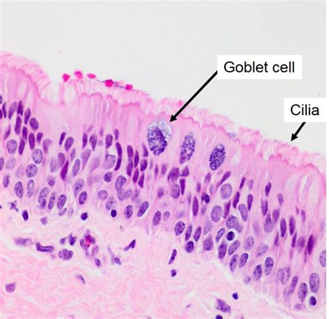 Air conduction: Larynx, Trachea, Bronchi and Bronchioles – Veterinary Histology