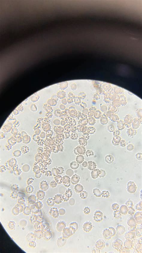 First and very poor attempt of a blood smear. Lots of echinocytes? : r/microscopy