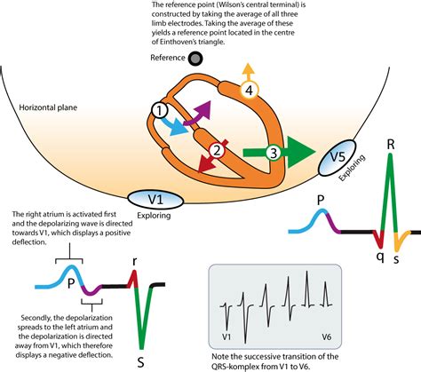 ECG interpretation: Characteristics of the normal ECG (P-wave, QRS complex, ST segment, T-wave ...