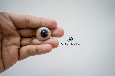 Prosthetic Eye Gallery 2