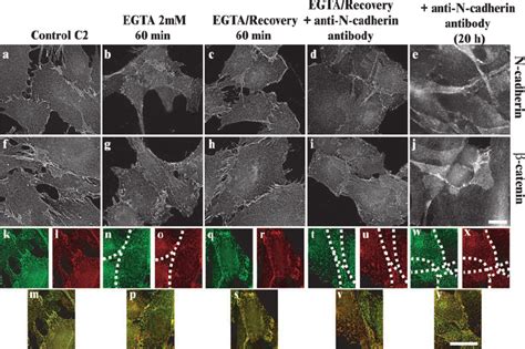 N-cadherin and ␤ -catenin accumulation in cell–cell junctions is... | Download Scientific Diagram