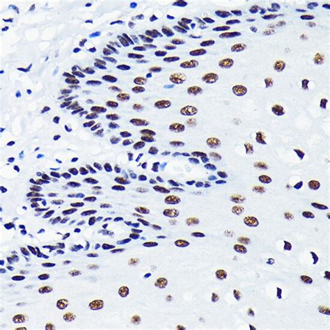 TDP-43 Antibody (MA5-35273)