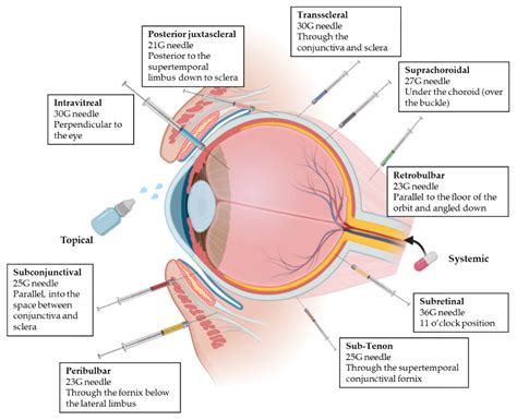 Lipid Nanoparticles for the Posterior Eye Segment - Pharma Excipients